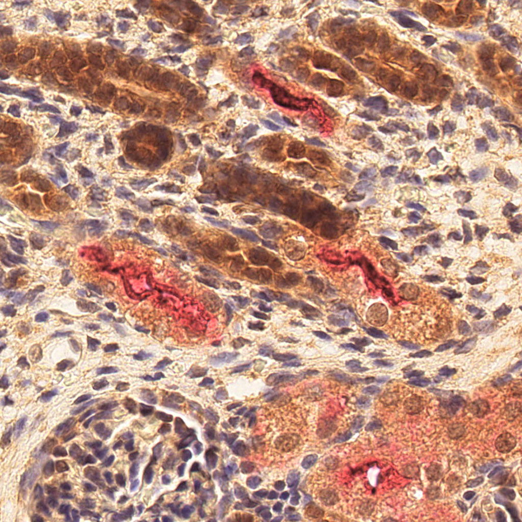 sars-cov-2 gene expression in a human fetus